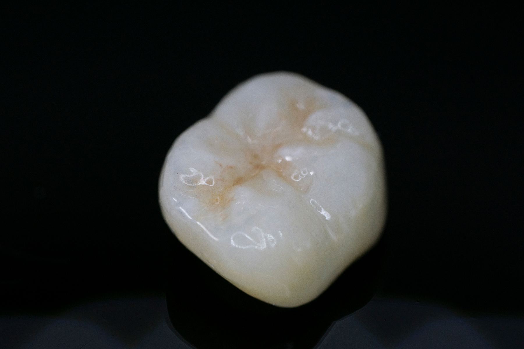 Macro photograph of a finished zirconia crown restoration