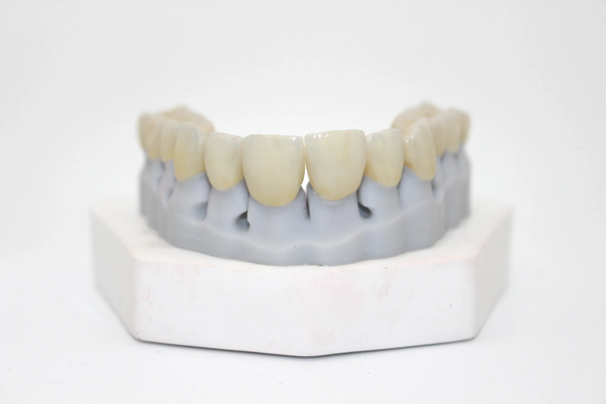 new ceramic teeth on a mold front side