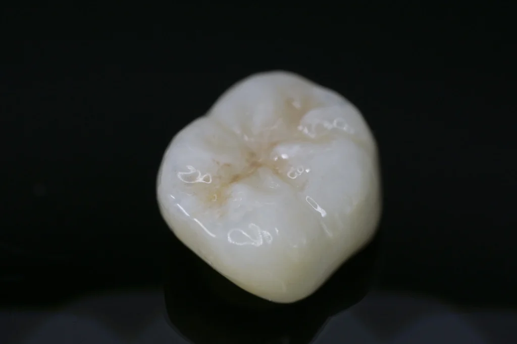 tooth outocome image