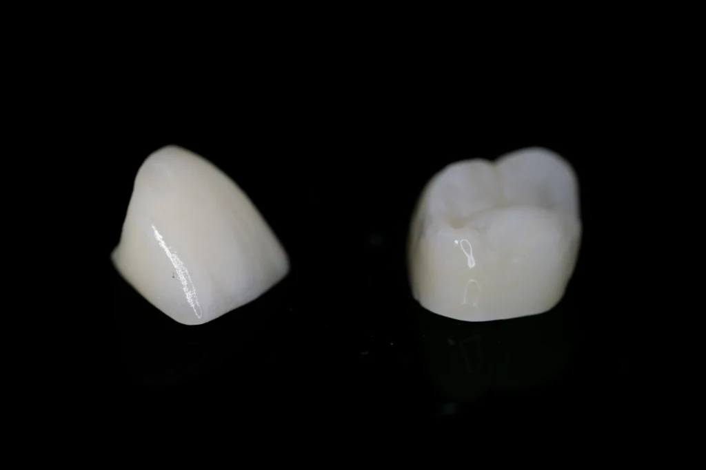 veneers hybrid