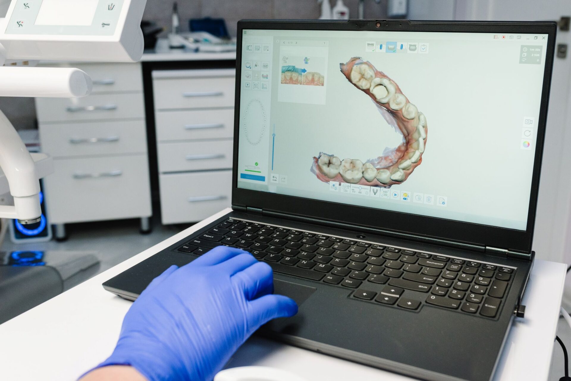 A dental professional wearing blue gloves uses a laptop displaying a 3D scan of a full dental arch. The screen shows a detailed digital impression used for planning full-arch restorations, showcasing modern CAD/CAM dental technology. The image captures a clinical setting, reflecting the integration of digital tools in restorative dentistry.